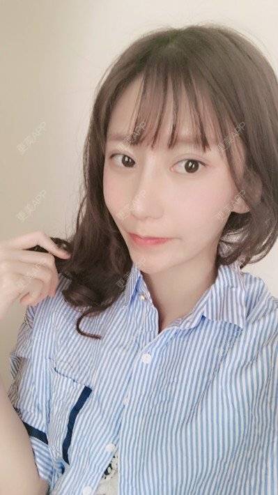 更美 - 更美用户58UrXXkMuu的鼻部多项经验 | 鼻部多项 | 鼻翼缩小 | 人工骨隆鼻 | 长鼻矫正 | 自体肋软骨垫鼻基底 | 福州