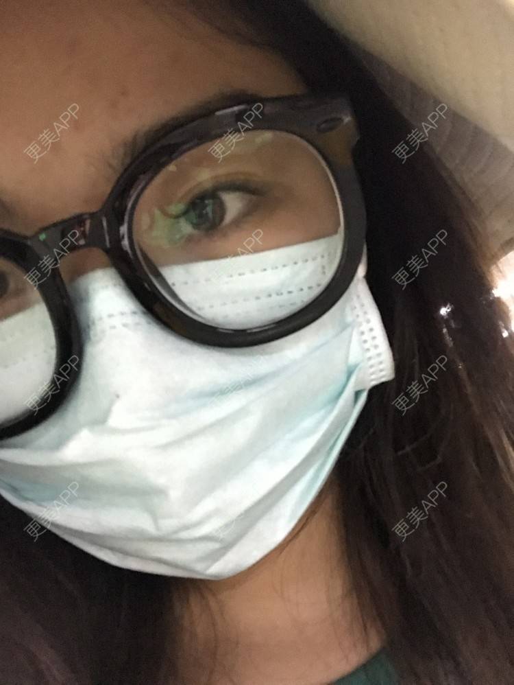 更美 - 婷啊婷tt的除皱瘦脸经验 | 除皱瘦脸 | 注射塑形腿部 | 长沙