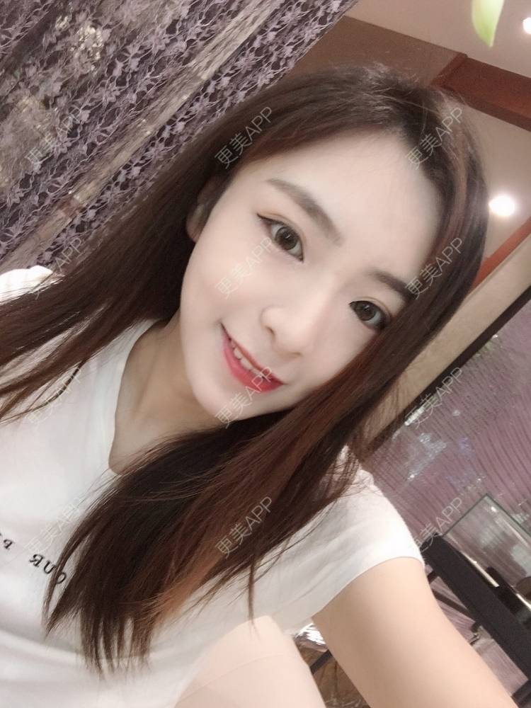 更美 - 更美用户PCeRKxunmA的膨体垫下巴经验 | 上海 | 膨体垫下巴