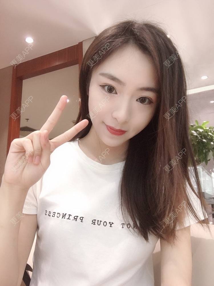 更美 - 更美用户PCeRKxunmA的膨体垫下巴经验 | 上海 | 膨体垫下巴