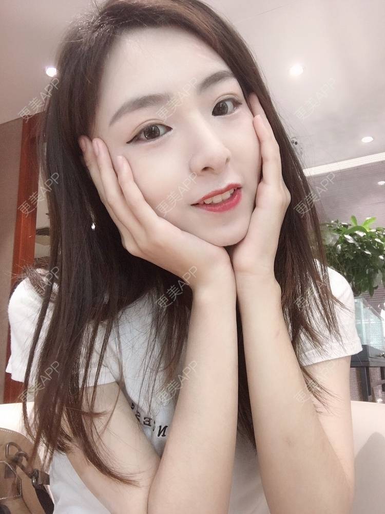 更美 - 更美用户PCeRKxunmA的膨体垫下巴经验 | 上海 | 膨体垫下巴