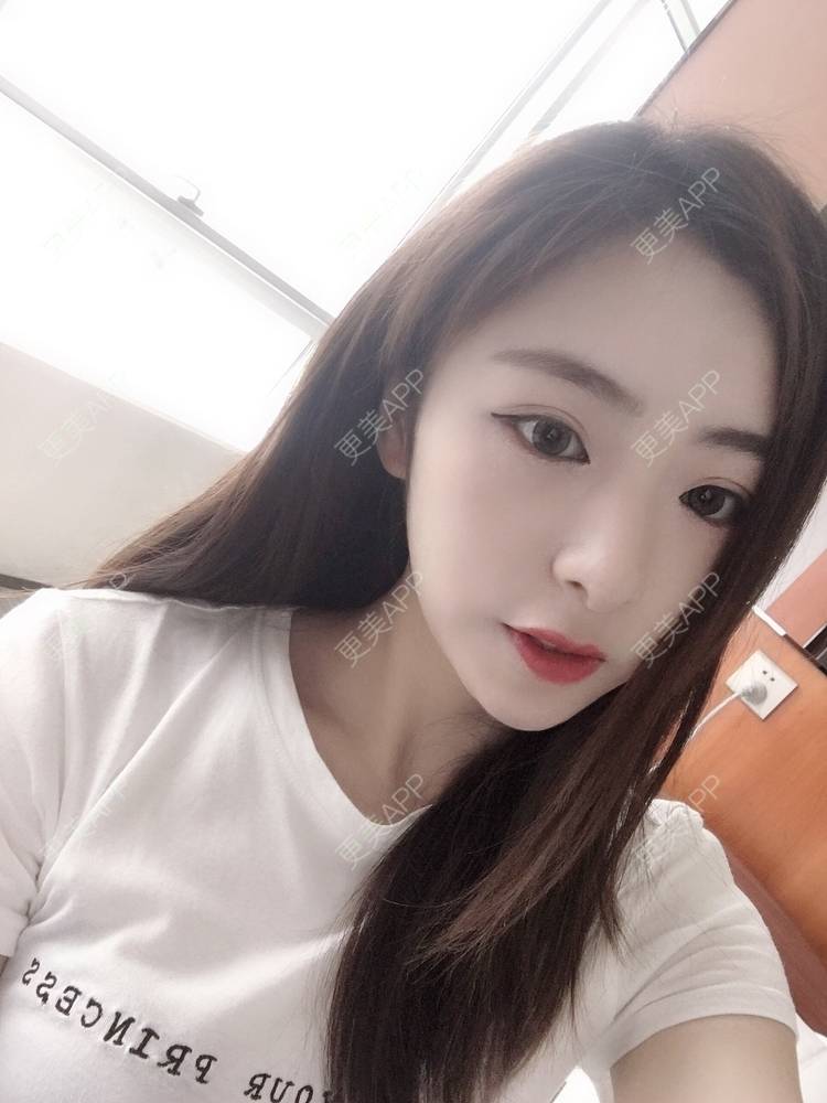 更美 - 更美用户PCeRKxunmA的膨体垫下巴经验 | 上海 | 膨体垫下巴