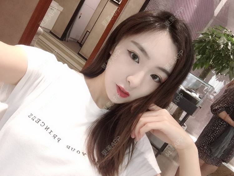 更美 - 更美用户PCeRKxunmA的膨体垫下巴经验 | 上海 | 膨体垫下巴