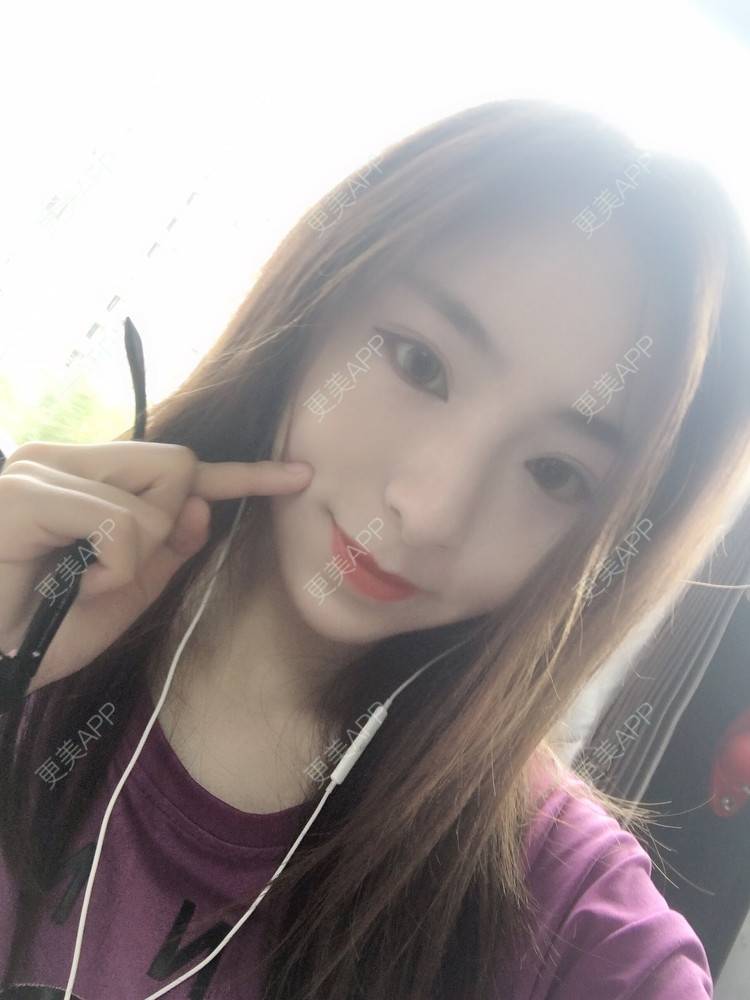 更美 - 更美用户PCeRKxunmA的膨体垫下巴经验 | 上海 | 膨体垫下巴