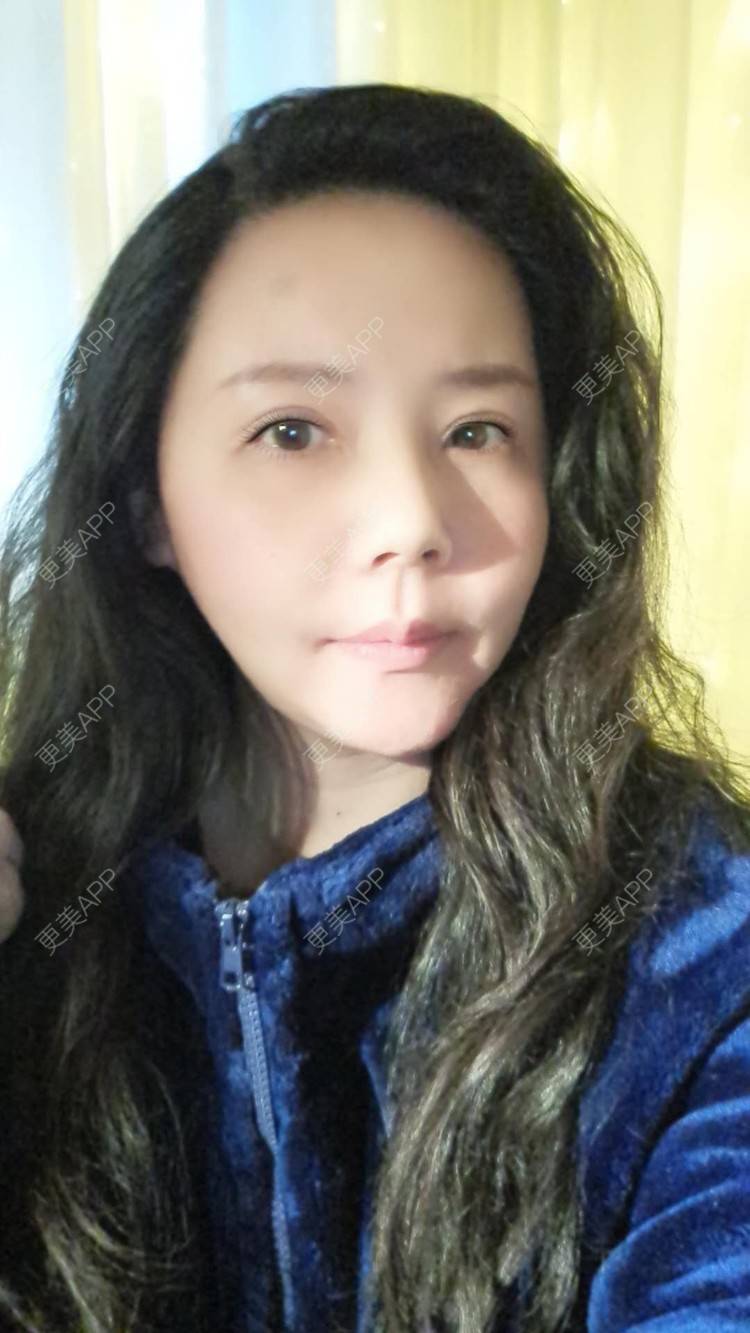 更美 - 更美用户amyZHbrzsl的根管治疗经验 | 上海 | 根管治疗