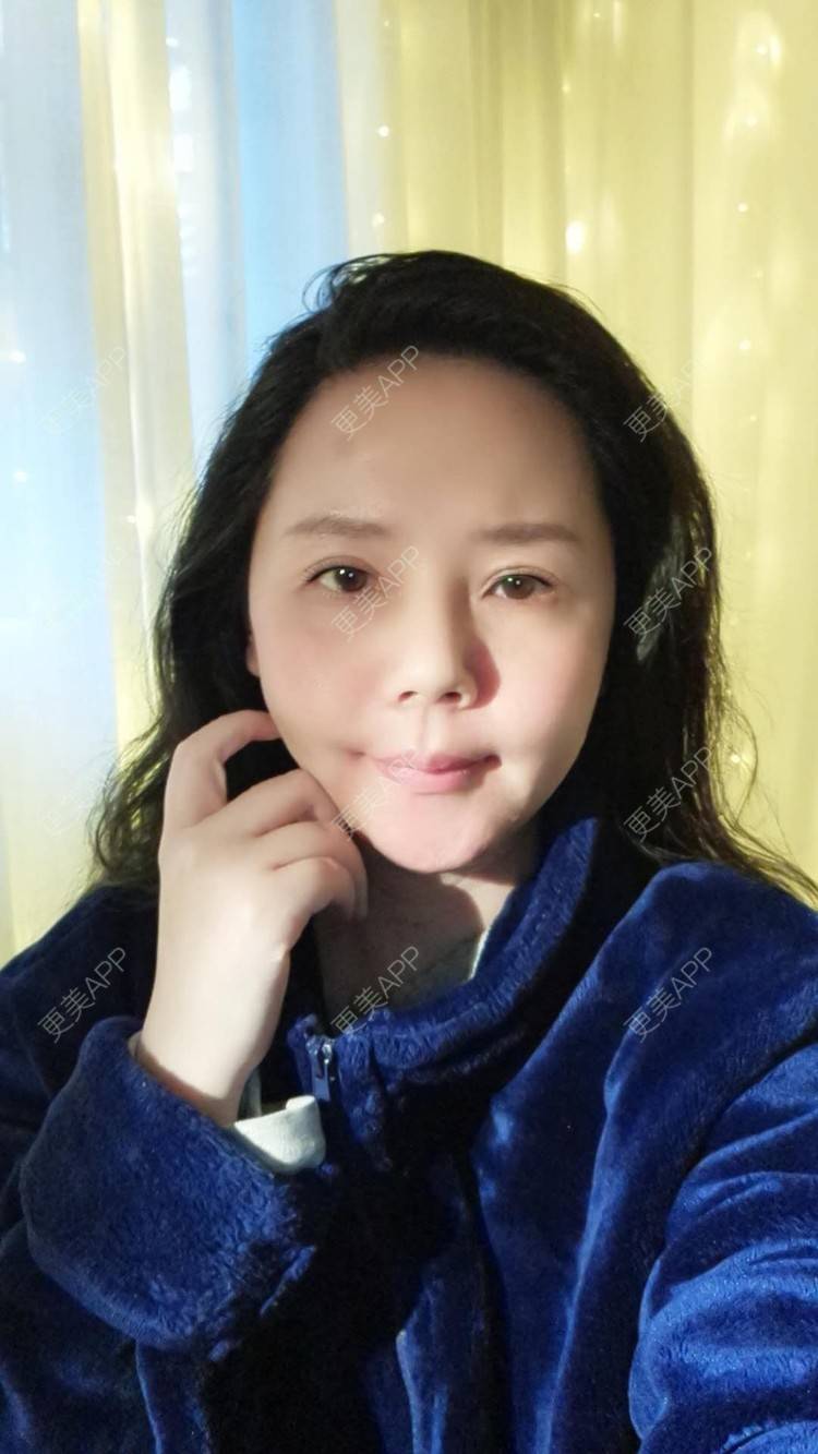 更美 - 更美用户amyZHbrzsl的根管治疗经验 | 上海 | 根管治疗