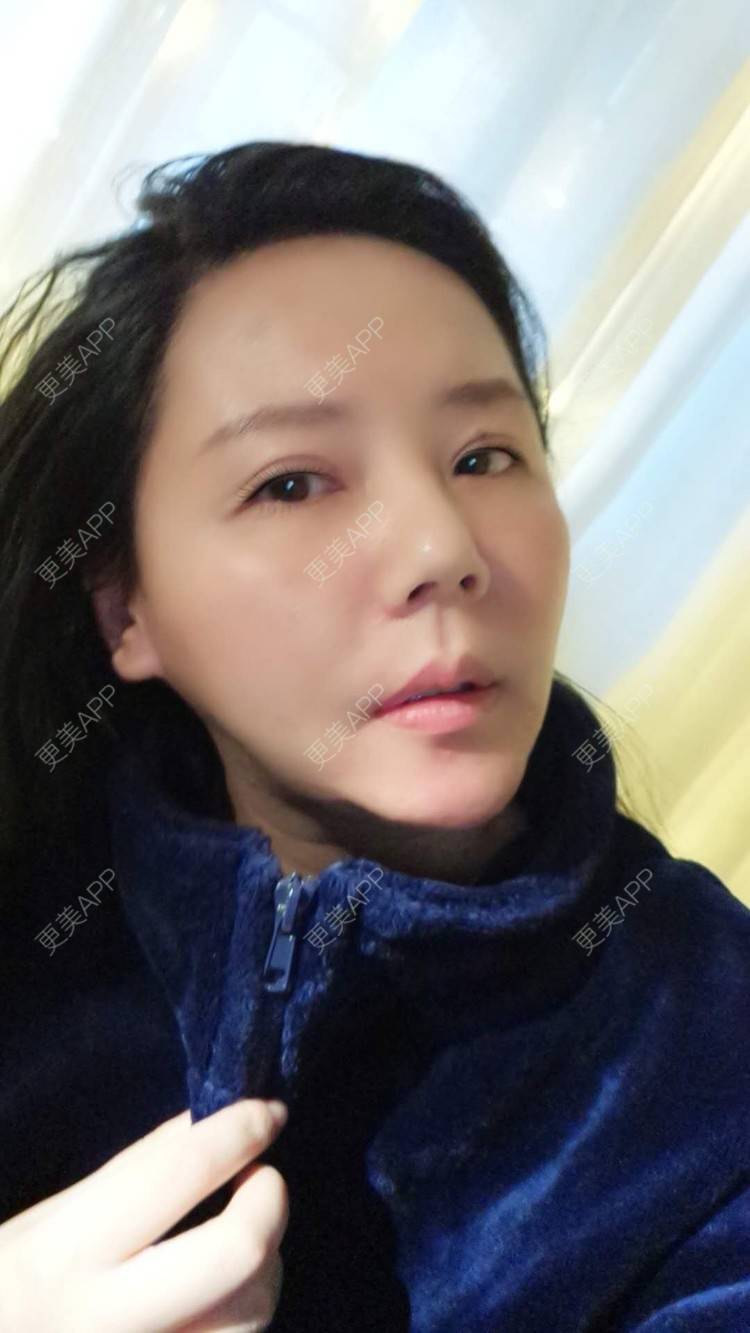 更美 - 更美用户amyZHbrzsl的根管治疗经验 | 上海 | 根管治疗