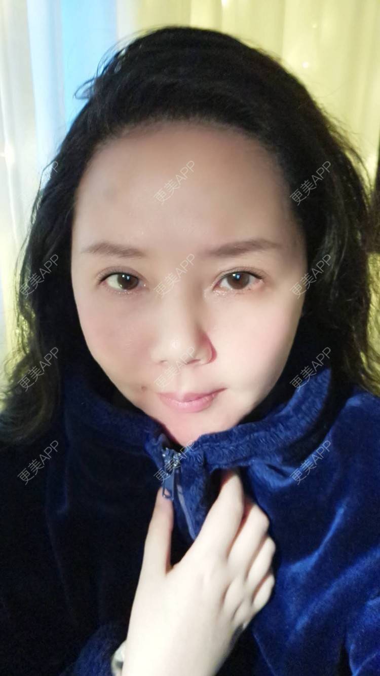 更美 - 更美用户amyZHbrzsl的根管治疗经验 | 上海 | 根管治疗