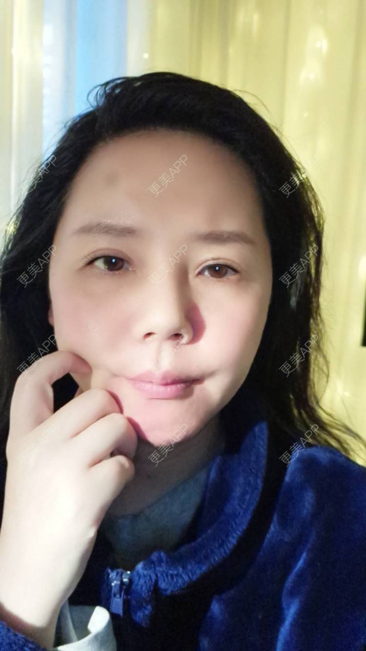 更美 - 更美用户amyZHbrzsl的根管治疗经验 | 上海 | 根管治疗