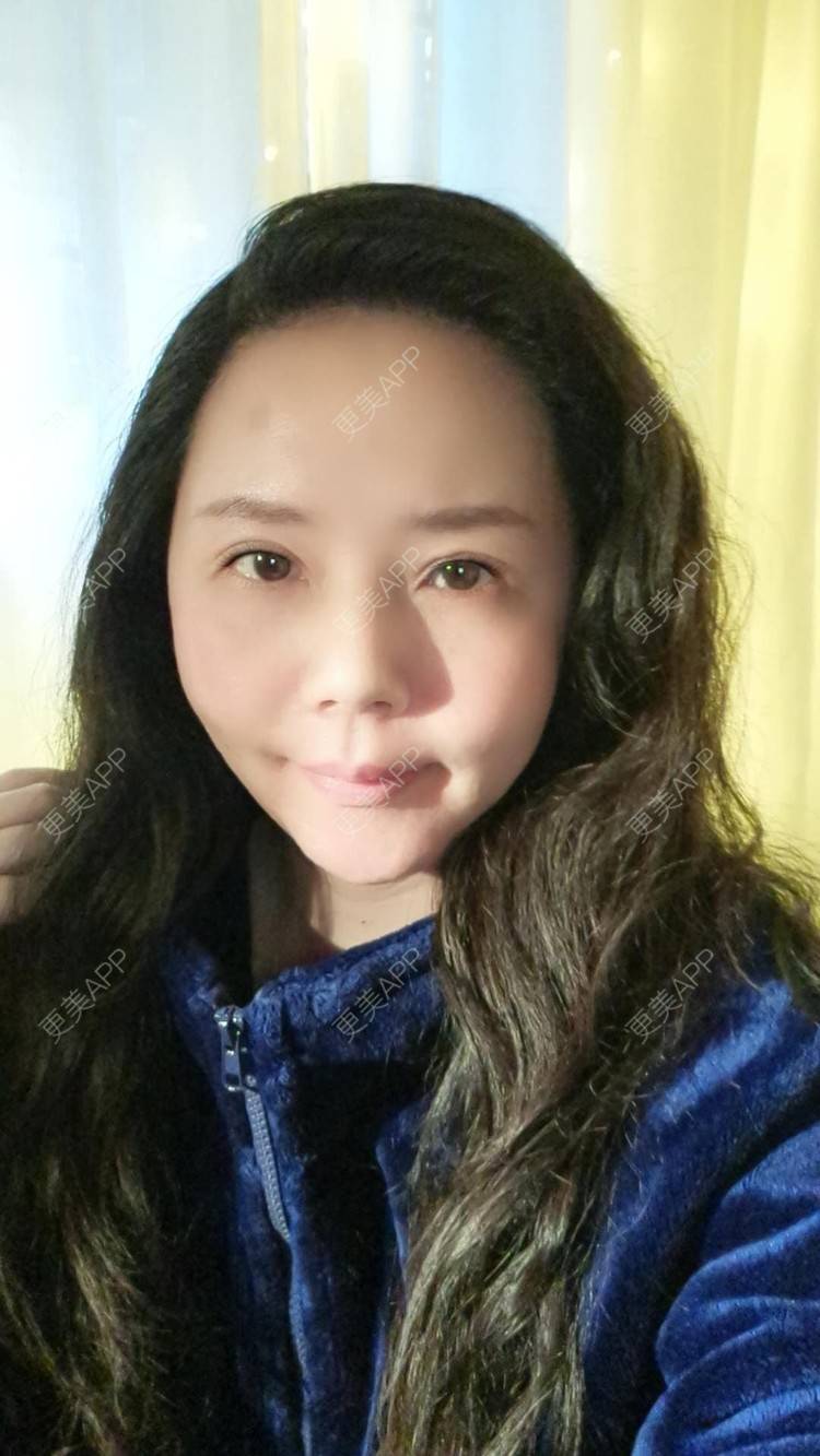 更美 - 更美用户amyZHbrzsl的根管治疗经验 | 上海 | 根管治疗