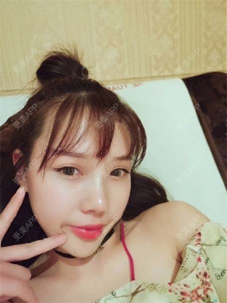 更美 - 更美用户vLh7GAnhkk的眼部多项经验 | 眼部多项 | 佛山