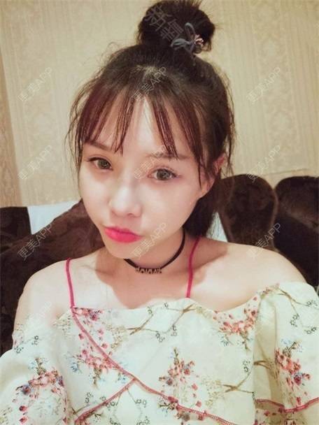 更美 - 更美用户vLh7GAnhkk的眼部多项经验 | 眼部多项 | 佛山