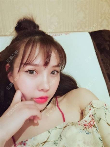 更美 - 更美用户vLh7GAnhkk的眼部多项经验 | 眼部多项 | 佛山