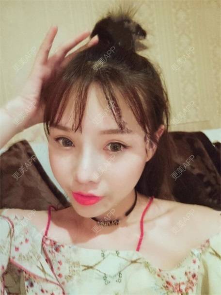 更美 - 更美用户vLh7GAnhkk的眼部多项经验 | 眼部多项 | 佛山