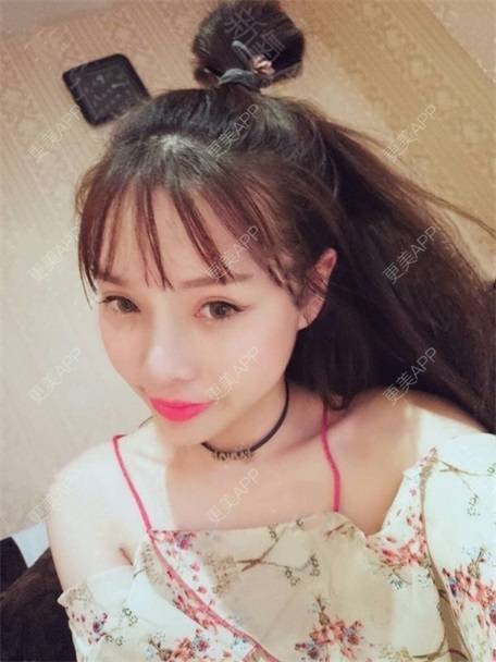 更美 - 更美用户vLh7GAnhkk的眼部多项经验 | 眼部多项 | 佛山