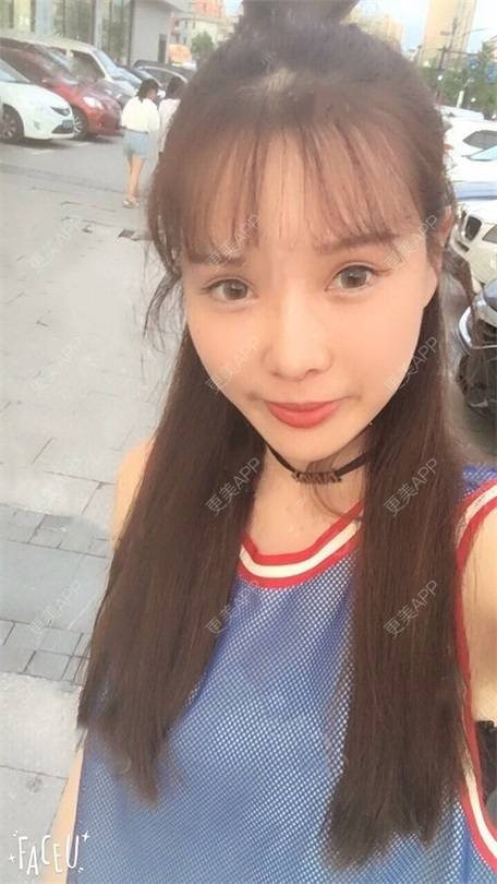 更美 - 更美用户vLh7GAnhkk的眼部多项经验 | 眼部多项 | 佛山