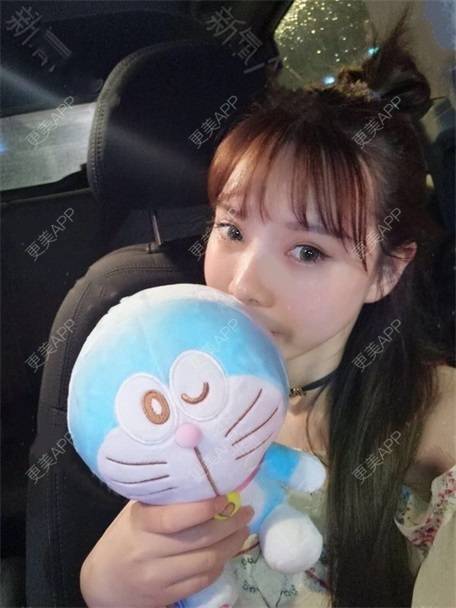 更美 - 更美用户vLh7GAnhkk的眼部多项经验 | 眼部多项 | 佛山