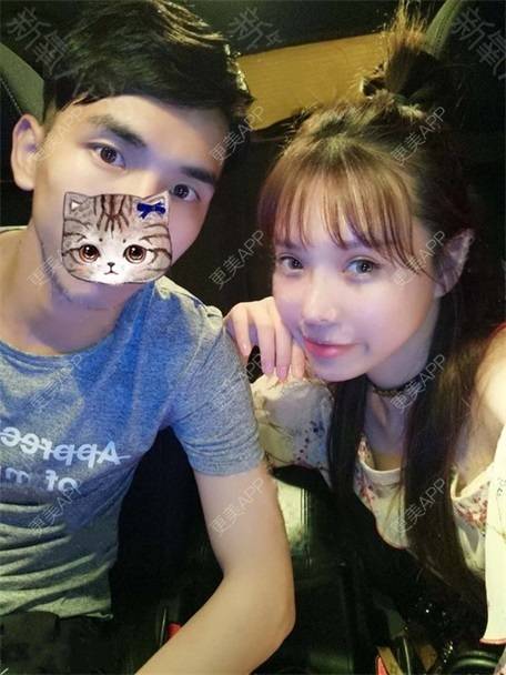 更美 - 更美用户vLh7GAnhkk的眼部多项经验 | 眼部多项 | 佛山