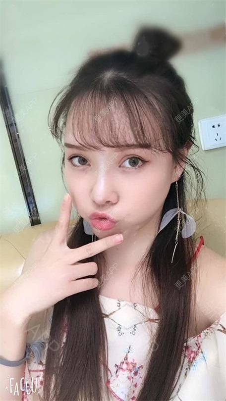 更美 - 更美用户vLh7GAnhkk的眼部多项经验 | 眼部多项 | 佛山