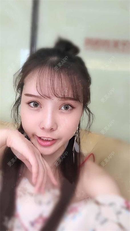 更美 - 更美用户vLh7GAnhkk的眼部多项经验 | 眼部多项 | 佛山