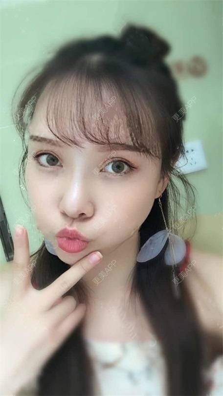 更美 - 更美用户vLh7GAnhkk的眼部多项经验 | 眼部多项 | 佛山