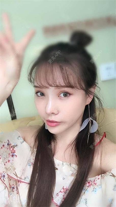 更美 - 更美用户vLh7GAnhkk的眼部多项经验 | 眼部多项 | 佛山