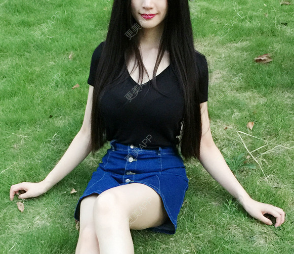 更美 - 更美用户wBYsgLTQ9p的假体隆胸经验 | 假体隆胸 | 广州