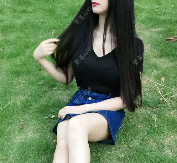 更美 - 更美用户wBYsgLTQ9p的假体隆胸经验 | 假体隆胸 | 广州