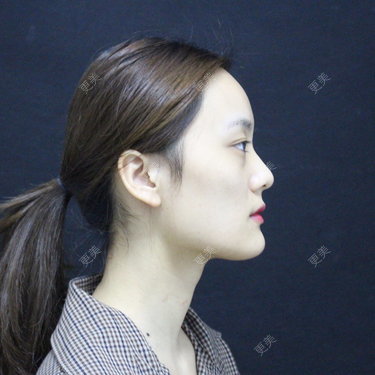 更美用户g2U36BucF7