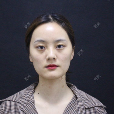更美用户g2U36BucF7