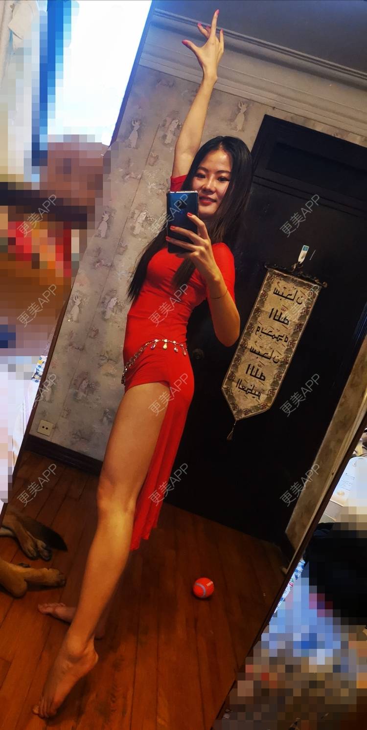 更美 - umgsd的植发际线经验 | 视频日记 | 植发际线 | 上海