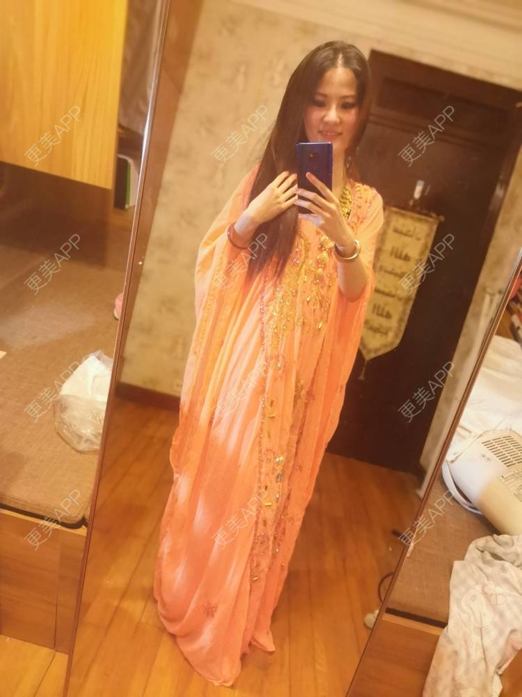 更美 - umgsd的植发际线经验 | 视频日记 | 植发际线 | 上海