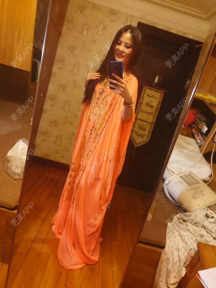 更美 - umgsd的植发际线经验 | 视频日记 | 植发际线 | 上海