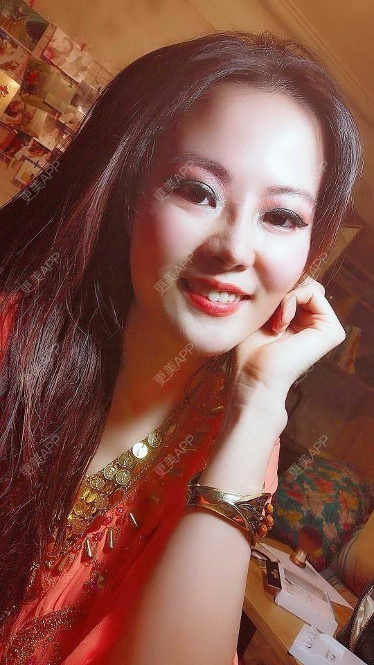 更美 - umgsd的植发际线经验 | 视频日记 | 植发际线 | 上海