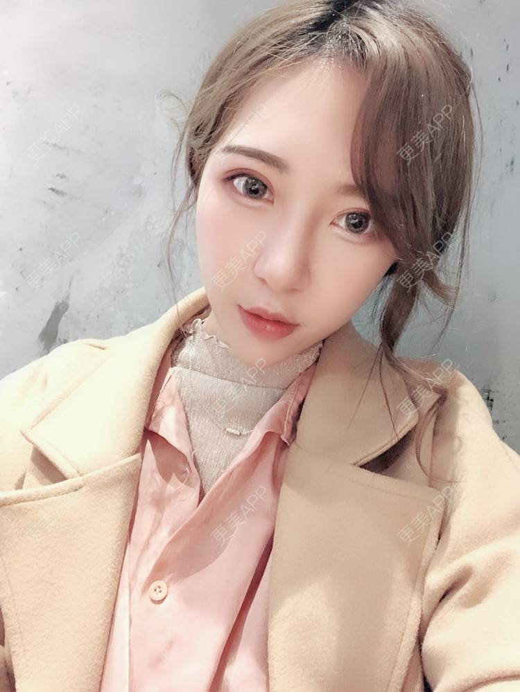 更美 - 一切为了_爱讲的激光淡疤经验 | 综合淡疤 | 激光淡疤 | 成都 | 美白嫩肤