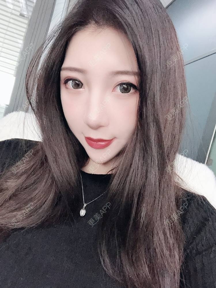 更美 - 一切为了_爱讲的激光淡疤经验 | 综合淡疤 | 激光淡疤 | 成都 | 美白嫩肤