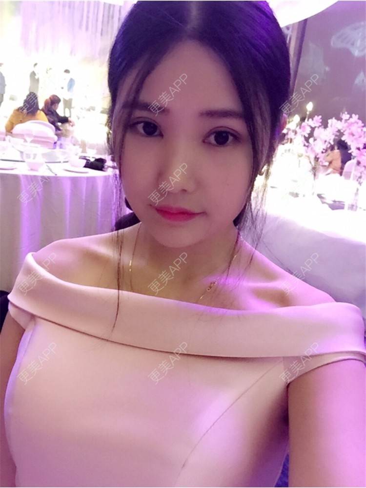 更美 - 更美用户3YgwAelLVw的胶原蛋白淡化黑眼圈经验 | 杭州 | 胶原蛋白淡化黑眼圈