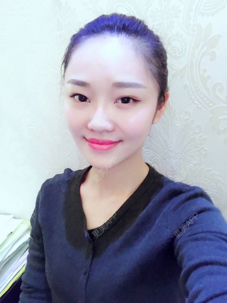 更美 - 更美用户4bRKTqR2Jo的埋线提升经验 | 埋线提升 | 无锡