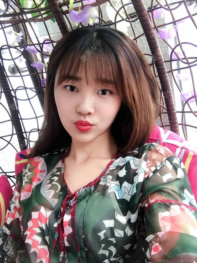 更美 - 更美用户4bRKTqR2Jo的埋线提升经验 | 埋线提升 | 无锡