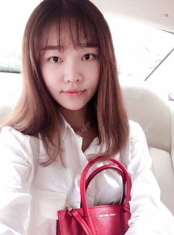 更美 - 更美用户4bRKTqR2Jo的埋线提升经验 | 埋线提升 | 无锡