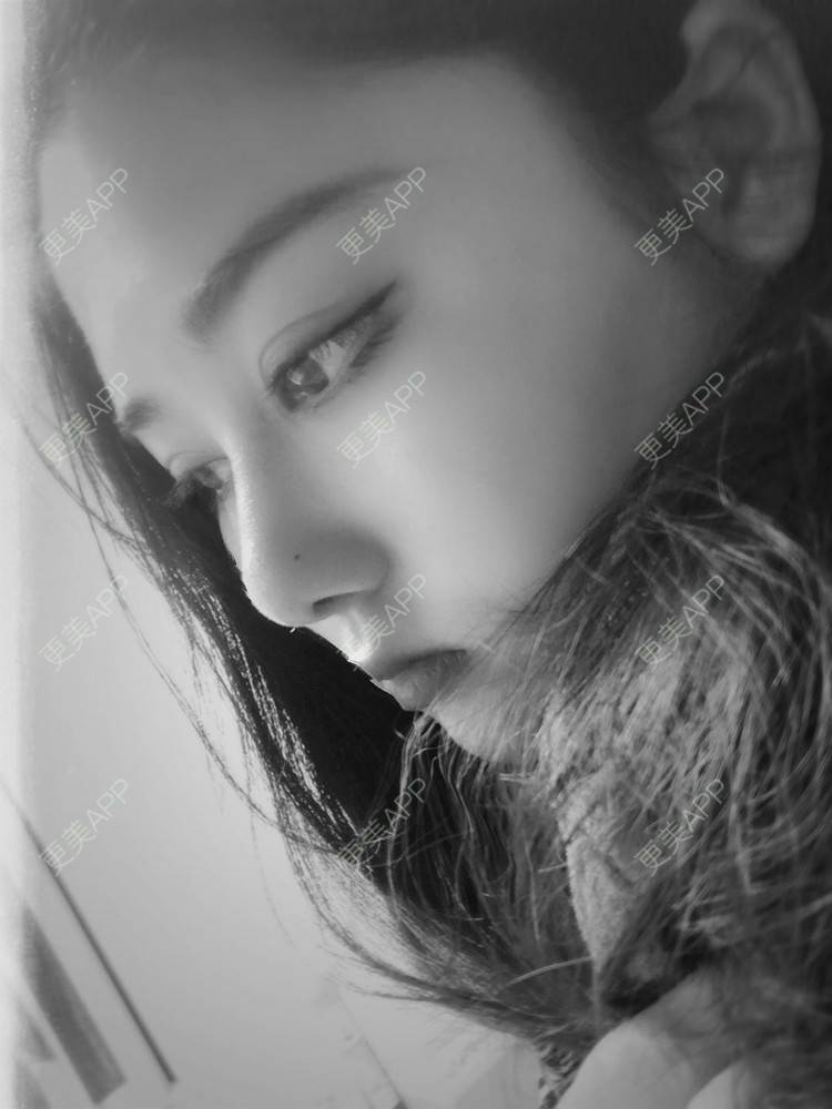 更美 - 无需解释收的鼻部多项经验 | 鼻小柱延长 | 视频日记 | 重庆 | 肋软骨隆鼻 | 鼻部多项