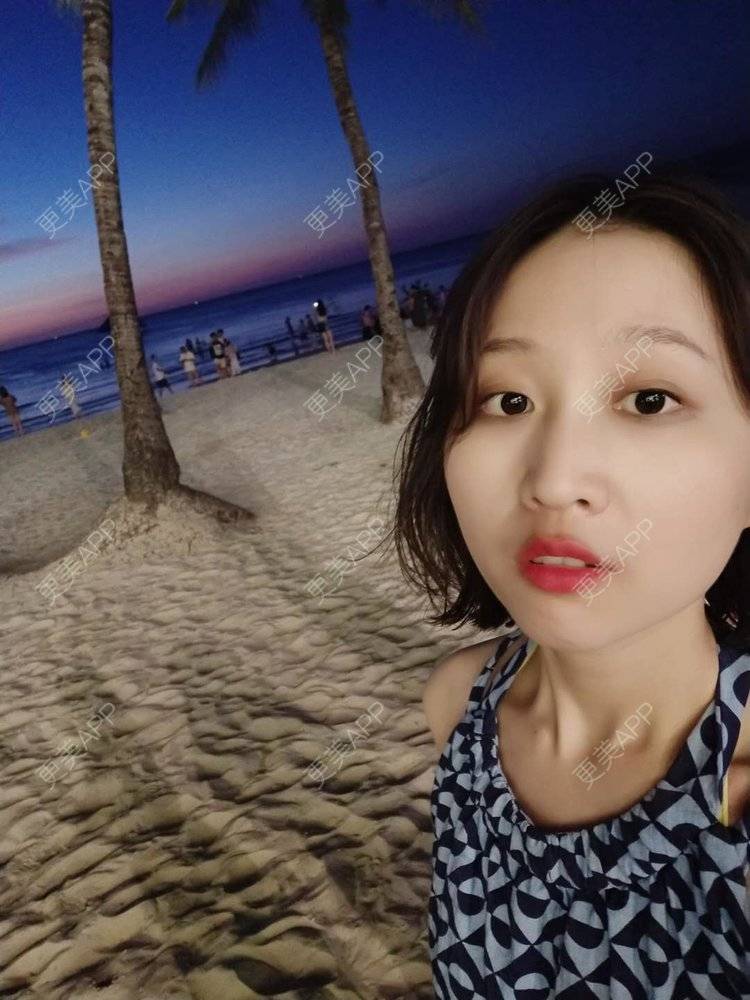 更美 - 更美用户xHKODsz5sq的热玛吉经验 | 热玛吉