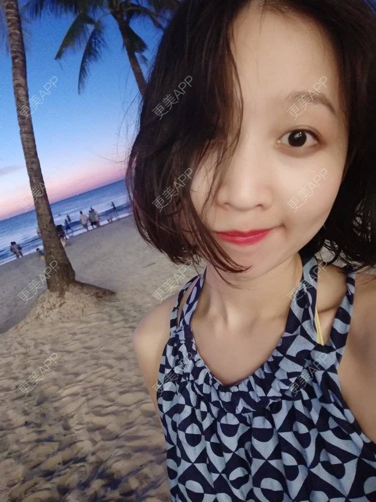 更美 - 更美用户xHKODsz5sq的热玛吉经验 | 热玛吉
