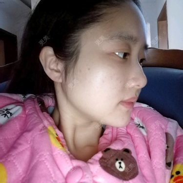 LHY_ir434