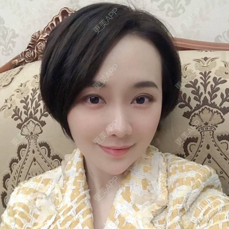 更美 - 勾勾手指剂的皮秒激光经验 | 皮秒激光 | 无锡