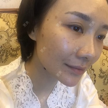 勾勾手指剂