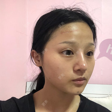 更美用户h3eiJuwKGo