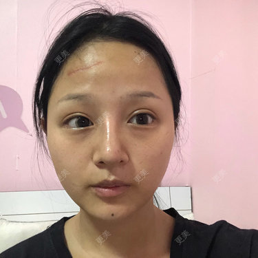 更美用户h3eiJuwKGo