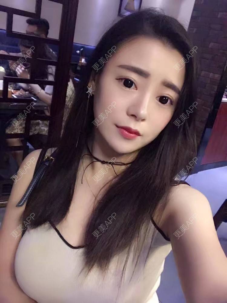 更美 - 初秋繁华落尽的假体隆胸经验 | 丰胸（隆胸） | 假体隆胸 | 南京