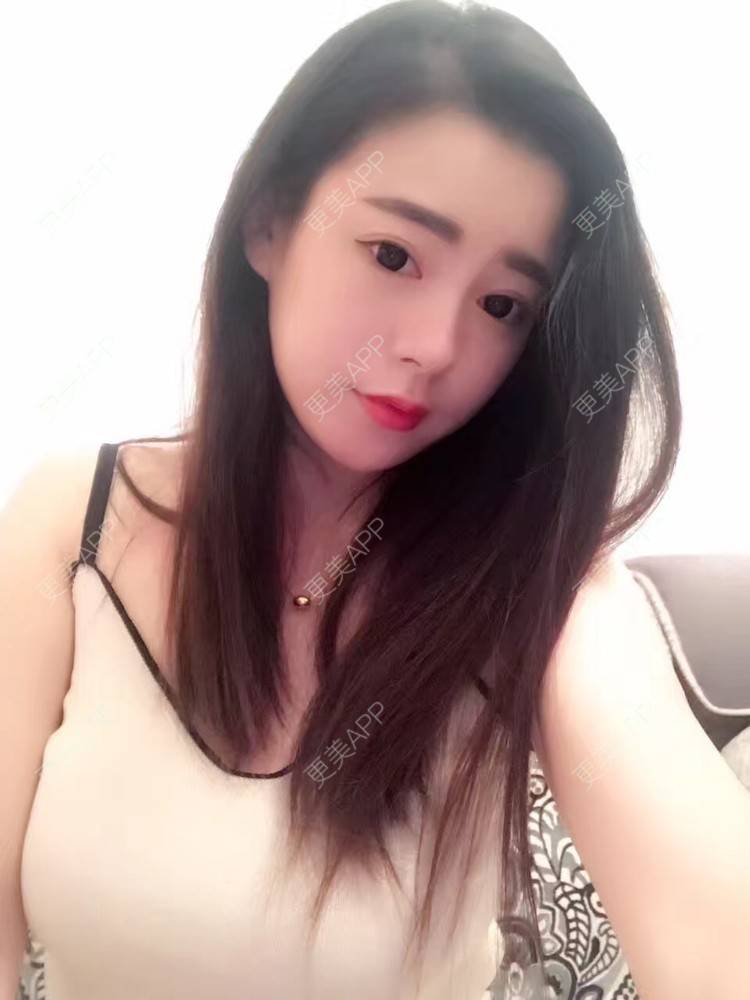 更美 - 初秋繁华落尽的假体隆胸经验 | 丰胸（隆胸） | 假体隆胸 | 南京